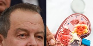 Ivica Dačić ne boluje samo od upale pluća, ovu bolest je ignorisao godinama, a tiho razara sve organe: Srbi zanemaruju dok stanje ne postane opasno