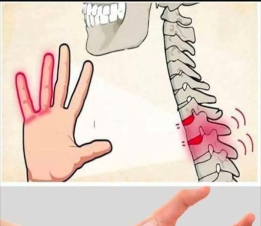 Ako vam ruke ili stopala utrnu, to može biti jasan znak da imate…