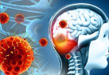 Koji su simptomi, kako se širi i kako se liječi meningitis B?