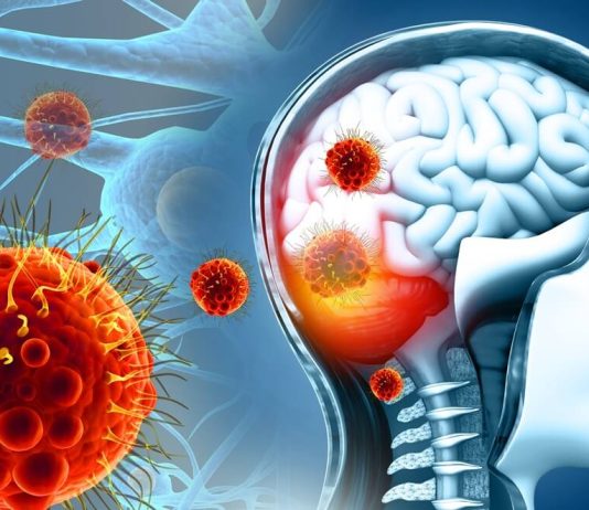 Koji su simptomi, kako se širi i kako se liječi meningitis B?