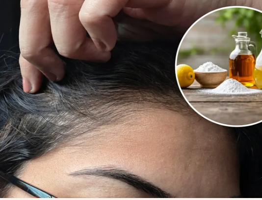 Koje su prednosti korištenja octa i sode bikarbone za uklanjanje sijede kose i kako to pravilno napraviti?