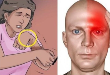 Evo kako spasiti nekoga tko ima moždani udar: potrebna vam je samo jedna stvar