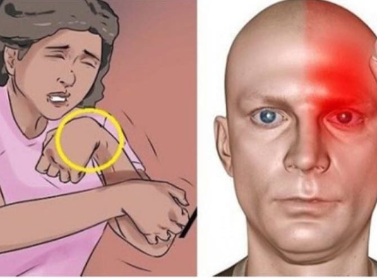 Evo kako spasiti nekoga tko ima moždani udar: potrebna vam je samo jedna stvar