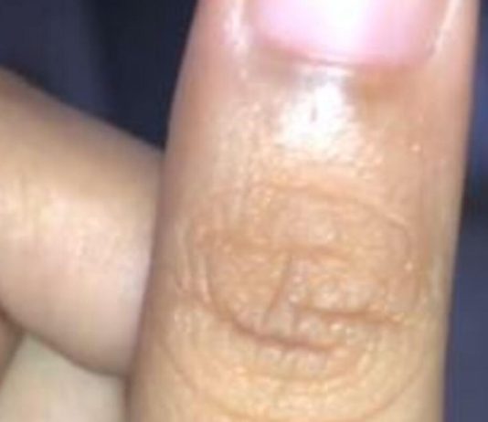 Svi imamo neko slovo na palcu lijeve ruke: Pronađite svoje i saznajte šta vam je sudbina odredila