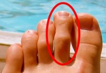 IMATE LI OVAKAV N0ŽNI PRST? Mnogima je ovo odvratno, A EVO KAKVU TAJNU KRIJE