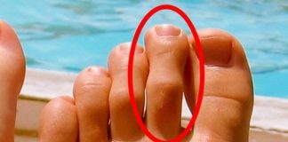 IMATE LI OVAKAV N0ŽNI PRST? Mnogima je ovo odvratno, A EVO KAKVU TAJNU KRIJE