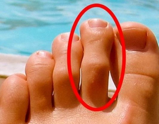 IMATE LI OVAKAV N0ŽNI PRST? Mnogima je ovo odvratno, A EVO KAKVU TAJNU KRIJE