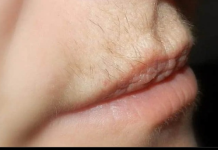 Dlačice iznad usana ovako će zauvijek nestati: Trik u koji se kunu milioni žena