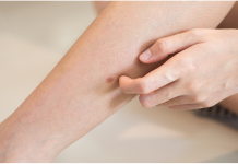 Šta uzrokuje svrab na različitim dijelovima tijela: kada je bezopasan, a kada potražiti savjet ljekara