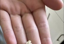 “Neočekivano i šokantno iskustvo: Ono što je izašlo iz mog grla će vas ostaviti bez riječi 😳” “Neočekivano i šokantno iskustvo: Ono što je izašlo iz mog grla će vas ostaviti bez riječi 😳” - featured image