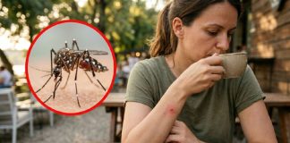 Kako ublažiti svrab od ujeda komarca? Nemojte da češete, ne treba ni krema samo jedna stvar