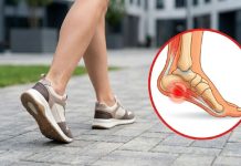 Ako osećate oštar probadajući bol u stopalu: Najgore vam ujutru? Evo šta elitni doktori savetuju