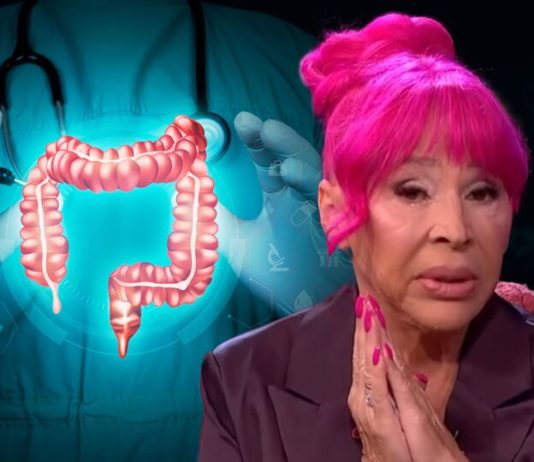 Šta je divertikuloza debelog creva? Uzroci, simptomi i lekcija koju nam je poslala Zorica Brunclik
